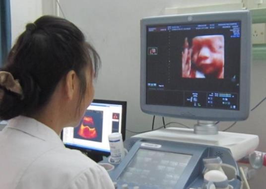 孕婦四維彩超能查什么?孕婦幾周可以做四維彩超