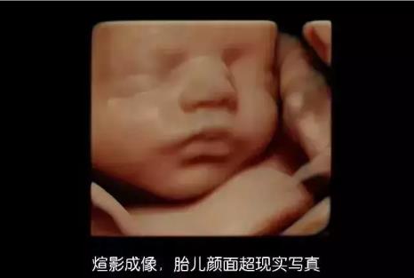 天津哪里做四維好?天津天孕醫(yī)院值得信賴