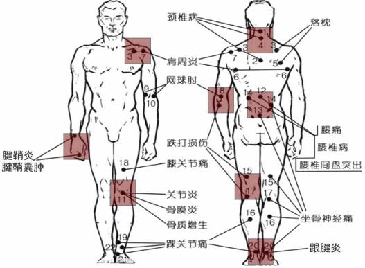 膏藥的使用方法 膏藥的正確貼法及貼膏藥禁忌