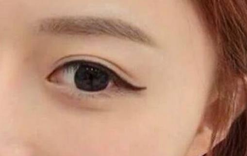 雙眼皮膠水怎么洗 雙眼皮膠水如何正確使用
