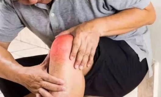 尿酸高的人可以吃瓜子嗎?尿酸高的人不可以吃什么?