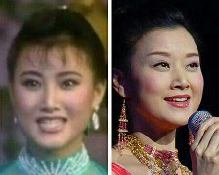 歲月是把殺豬刀也常常用在演藝明星身上