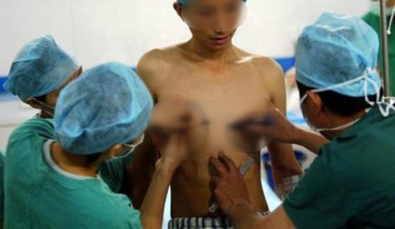 藥娘吃糖是什么意思 藥娘和人妖變性的區(qū)別 藥娘吃什么激素藥變性