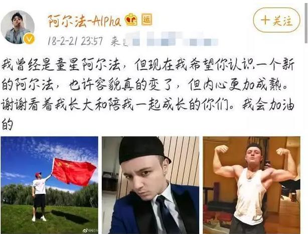 禿然長(zhǎng)大是什么意思?童星阿爾法19歲謝頂21歲植發(fā)成功分享經(jīng)歷