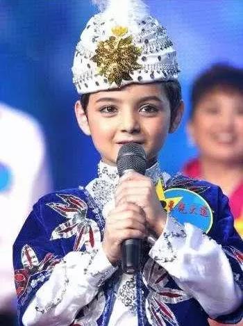 禿然長(zhǎng)大是什么意思?童星阿爾法19歲謝頂21歲植發(fā)成功分享經(jīng)歷