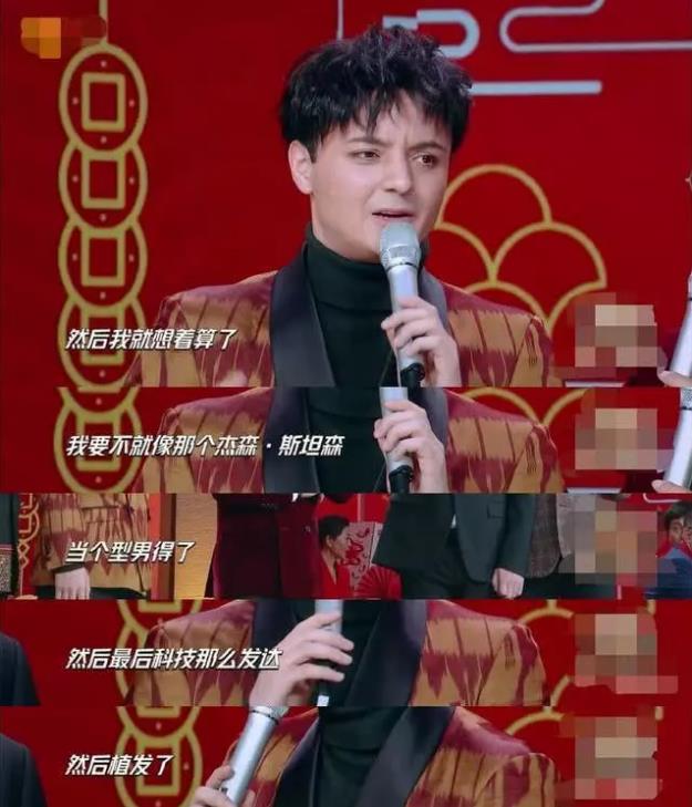 禿然長(zhǎng)大是什么意思?童星阿爾法19歲謝頂21歲植發(fā)成功分享經(jīng)歷