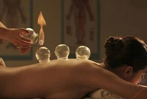 拔火罐能減肥嗎？拔火罐減肥的壞處