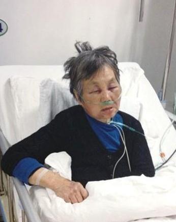 教授醉酒耍酒瘋殘忍毆打7旬老人令人發(fā)指，被打老人昏迷大小便失禁