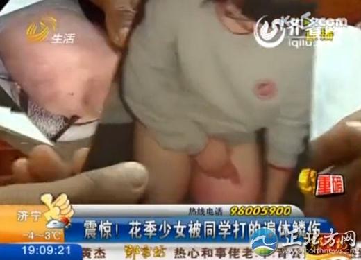 16歲花季少女被四名室友毆打4小時，脫光了跪在地上打，打得遍體鱗傷