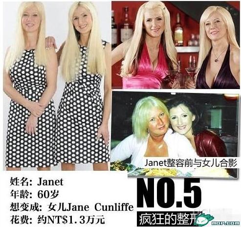 坑爹時代：那些奇葩的瘋狂變臉整容，坑爹呀