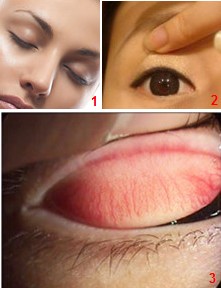 眼睛里進(jìn)東西怎么辦？眼睛進(jìn)異物怎么辦