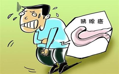 胰腺癌