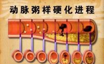 什么是“動(dòng)粥”？哪些是“動(dòng)粥疾病”高危人群？