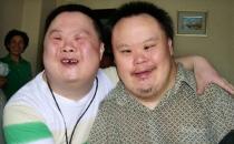 什么是唐氏綜合癥？