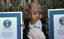 世界上最矮成人男子去世，享年75歲