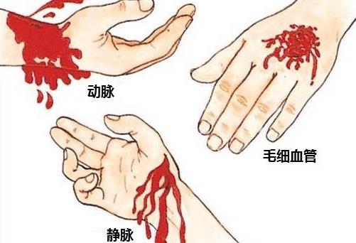 出血