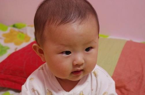 冬季養(yǎng)生 寶寶嘴唇干裂怎么辦
