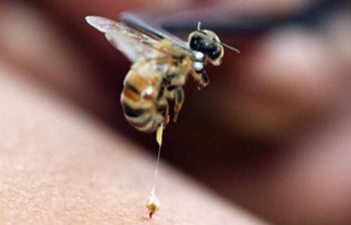 被蜂蜇了怎么辦？被蜂蜇的急救方法