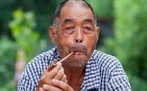 吸煙可引發(fā)冠心?。? /></a> </div>
                  <div   id=