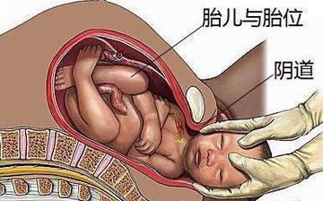 【分娩】分娩注意什么_分娩前的征兆_分娩視頻全過程_分娩后吃什么補(bǔ)身體 【分娩】分娩注意什么_分娩前的征兆_分娩視頻全過程_分娩后吃什么補(bǔ)身體