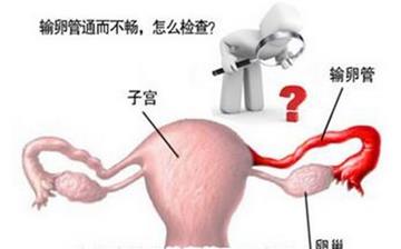 【輸卵管堵塞】輸卵管堵塞的癥狀_輸軟管堵塞檢查項目有哪些_輸軟管不通怎么治療
