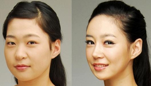 咬肌瘦臉針有什么危害？
