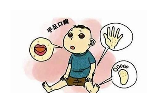 什么是手足口??？手足口病怎么治療