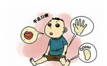 什么是手足口病？手足口病怎么治療