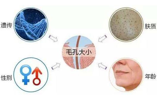 毛孔粗大吃什么好 收縮毛孔最佳飲食營養(yǎng)方案