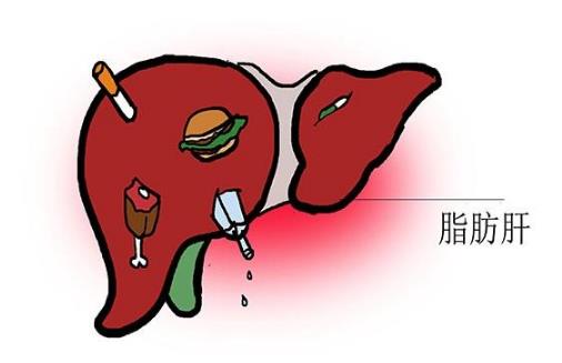 因?yàn)橐患?，有人脂肪肝逆轉(zhuǎn)回正常，有人演變成癌！就怕