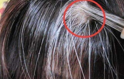 少年出現(xiàn)白頭發(fā)的主要原因 改善少年白的中醫(yī)技巧