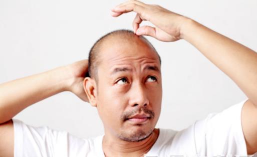 脫發(fā)或是疾病引起 防止脫發(fā)的最佳六大方法