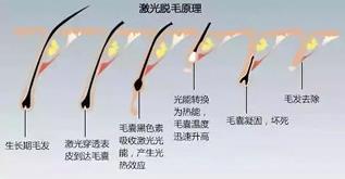 寧波薇琳整形醫(yī)院祛斑怎么樣？還您一張漂亮的容顏