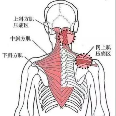 湛江崇愛康復醫(yī)院科普如何防治肌筋膜炎 以真誠來服務患者