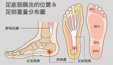 湛江崇愛康復醫(yī)院科普如何防治肌筋膜炎 以真誠來服務患者