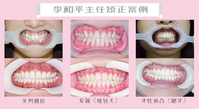天津市中諾口腔醫(yī)院 正畸主任李和平 講解矯正與年齡無關(guān)
