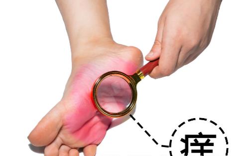 有腳氣的人，經(jīng)常用鹽水泡腳就能消滅真菌嗎？它沒有這個