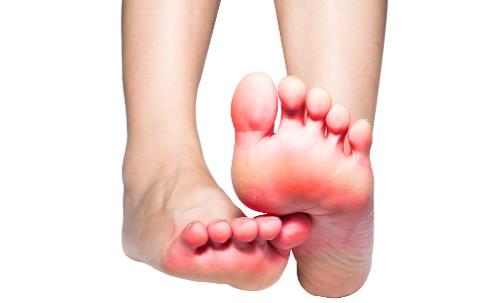 有腳氣的人，經(jīng)常用鹽水泡腳就能消滅真菌嗎？它沒有這個