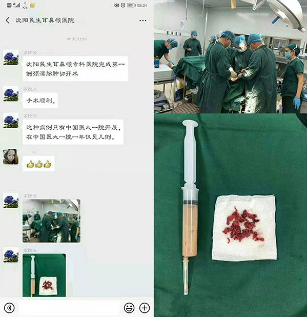 沈陽民生耳鼻喉醫(yī)院看耳鼻喉口碑如何呢 誠信行醫(yī)真心惠民