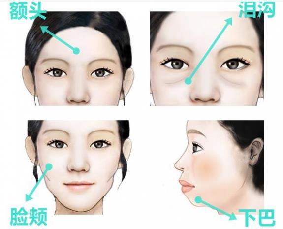 韋元強(qiáng)講解：瘦子也適合做自體脂肪填充嗎？