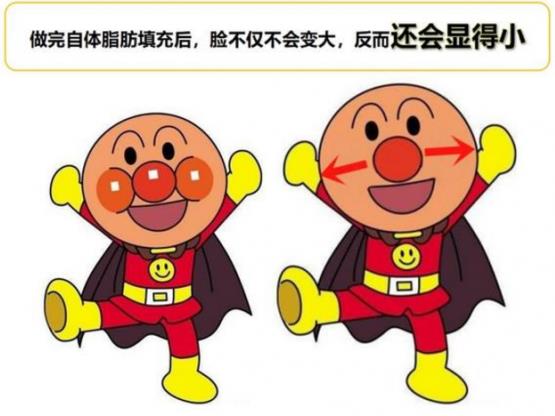 韋元強(qiáng)講解：瘦子也適合做自體脂肪填充嗎？