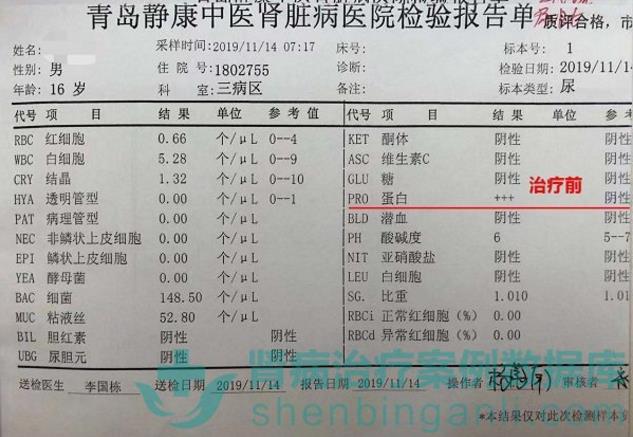 腎病綜合征小患者青島靜康中醫(yī)腎病醫(yī)院治療后病情改善