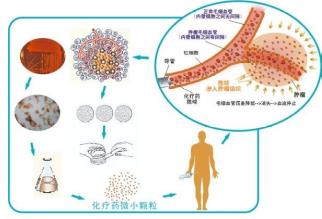 廣州復(fù)大腫瘤醫(yī)院牛立志教授：癌癥治療技術(shù)——血管介入療法