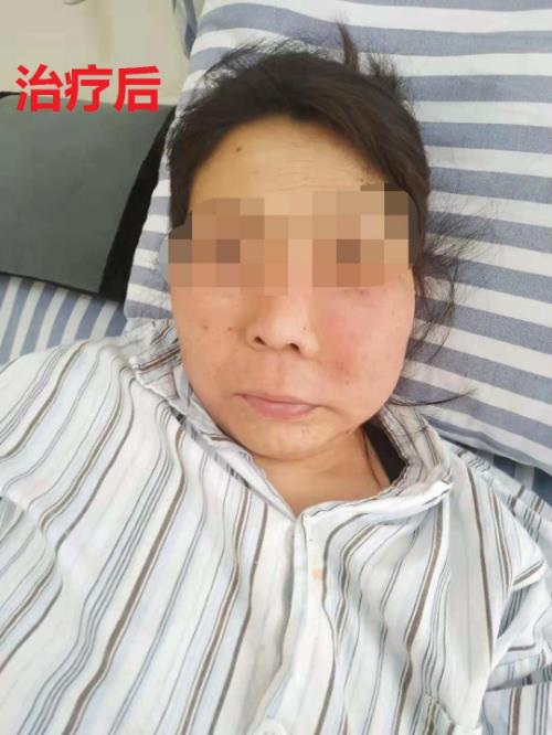 鄭州京美醫(yī)院腫瘤科好嗎？中醫(yī)專(zhuān)家 微創(chuàng)聯(lián)合治療