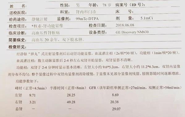 青島靜康醫(yī)院案例：明明是重度腎衰,血肌酐卻正常!化驗(yàn)單會說謊嗎?