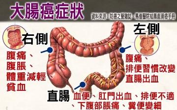【大腸癌】早期腸癌自檢方法及早期信號(hào)癥狀_什么樣的腹痛是腸癌 【大腸癌】早期腸癌自檢方法及早期信號(hào)癥狀_什么樣的腹痛是腸癌