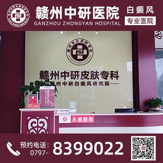 贛州白癜風(fēng)醫(yī)院離火車站多遠(yuǎn) 疫情期間白癜風(fēng)患者怎么提高免疫力