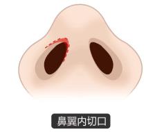 北京圣慈整形醫(yī)院鼻子王王軍怎么樣？專業(yè)實(shí)力 讓你放心美