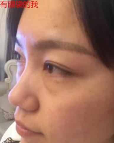 衛(wèi)婭日記：我一直都以為眼袋對(duì)我的影響只是美觀，直到我了解了以后……