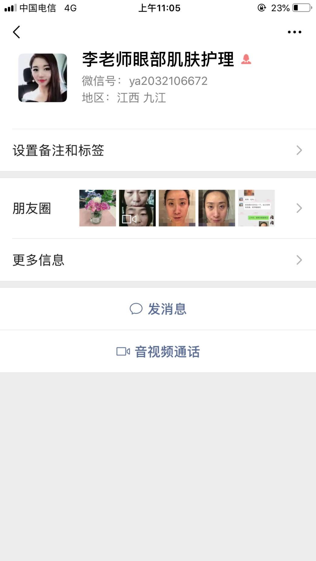 衛(wèi)婭日記：我一直都以為眼袋對(duì)我的影響只是美觀，直到我了解了以后……